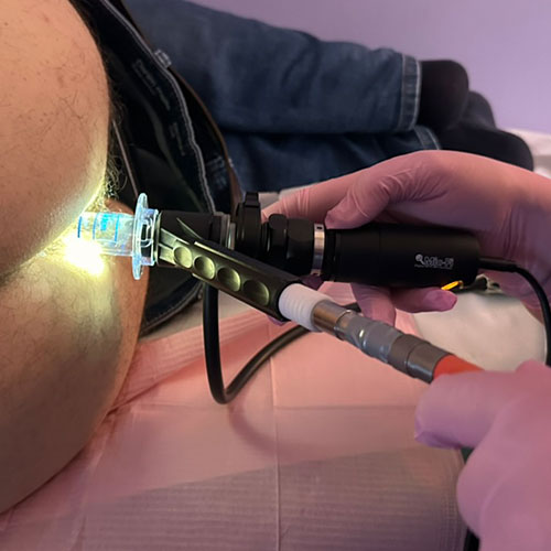 Videoproscoscopia Endoscopica Elettronica a Milano